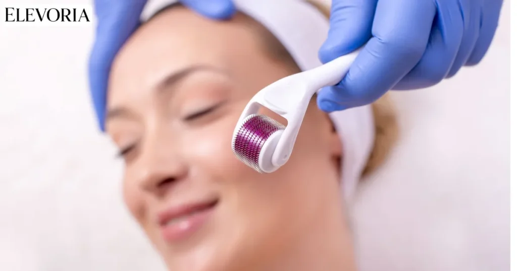 Microneedling (Micro Needle)