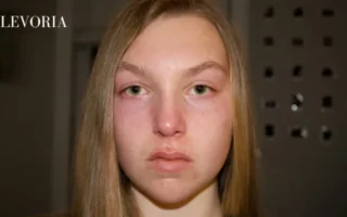 Pilaris on Face