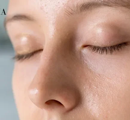 A close-up view of a woman with eyes closed, showing an oily shine along her nose and forehead alongside normal-to-dry cheek texture.