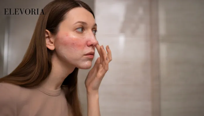 Keratosis Pilaris on Face