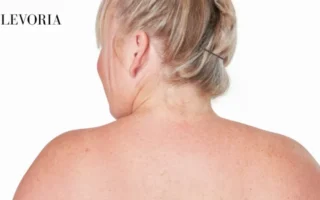 Raised Bumps on Skin