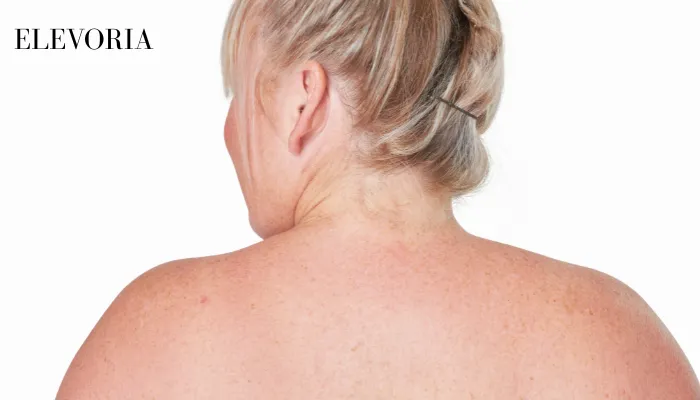 Raised Bumps on Skin