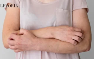 Pilaris Bumps