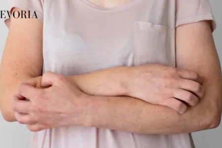Pilaris Bumps
