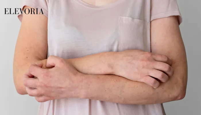 Pilaris Bumps