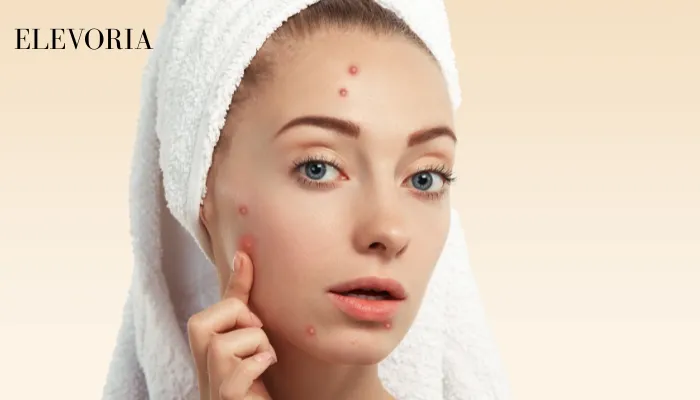 dark spot eliminator