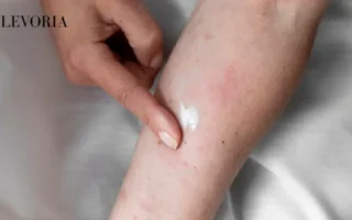Xerosis (Dry Skin)