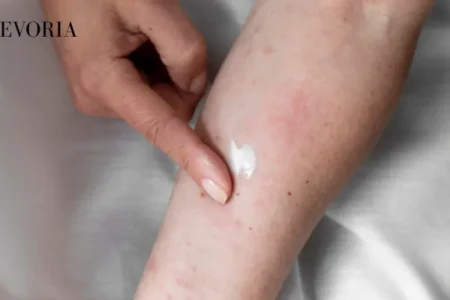 Xerosis (Dry Skin)