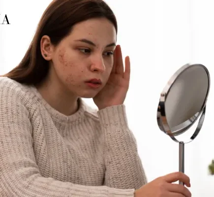 Dry and Flaky Skin on Face