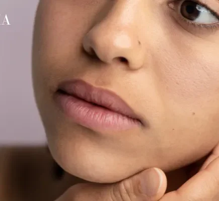 Dehydrated Skin