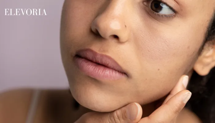 Dehydrated Skin