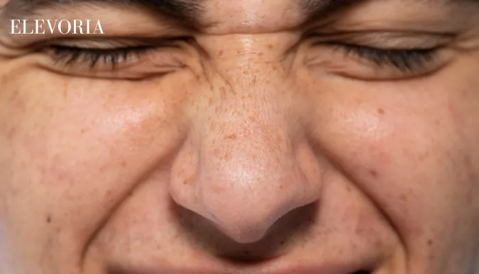 ageing marks on face