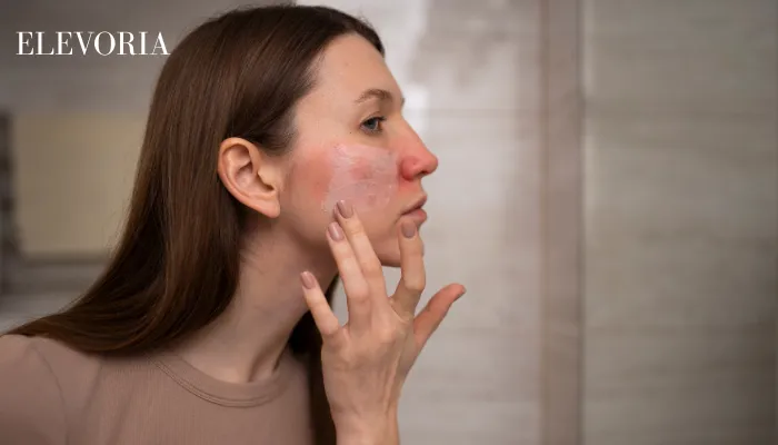 Dry Skin Patches