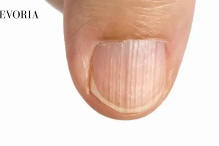 Ridges on Fingernails